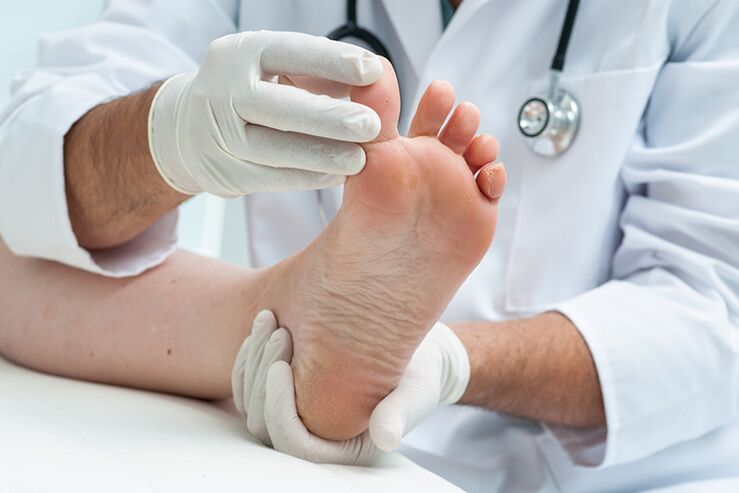 Dermatologist ënnersicht den Patient seng Been